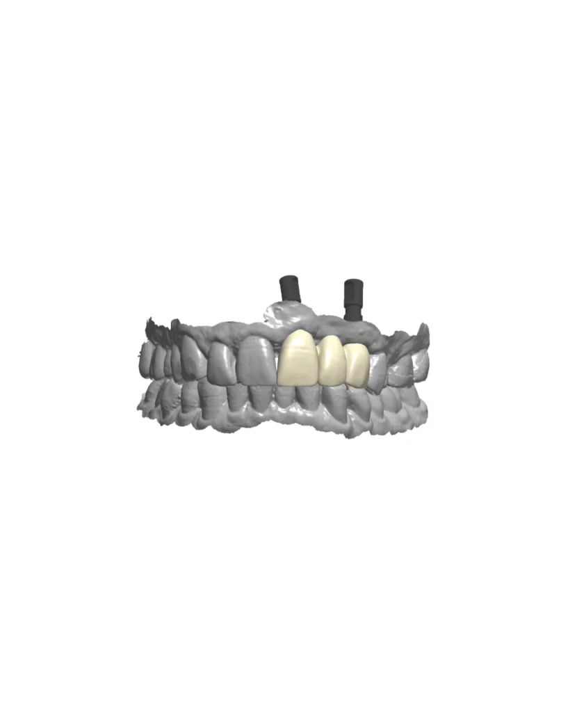 Home. Dentist in Garland, TX. Dr. Sarah Chan, DDS. Treat Dental