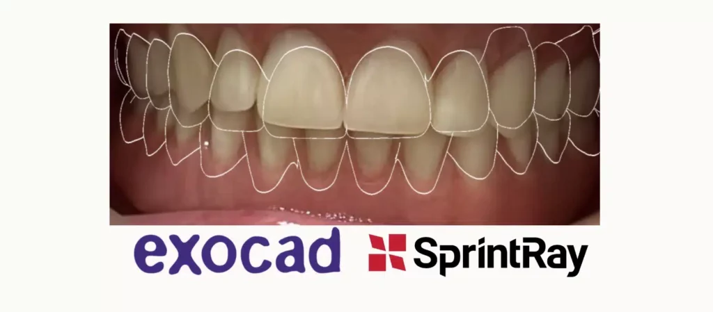 Home. Dentist in Garland, TX. Dr. Sarah Chan, DDS. Treat Dental