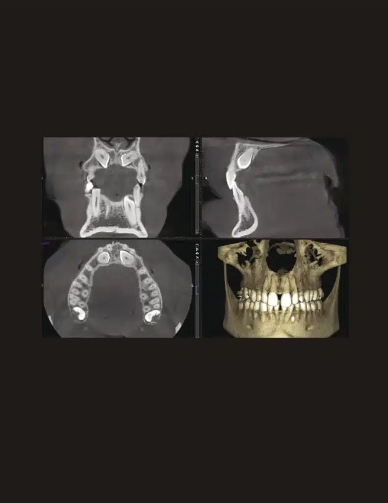 Home. Dentist in Garland, TX. Dr. Sarah Chan, DDS. Treat Dental