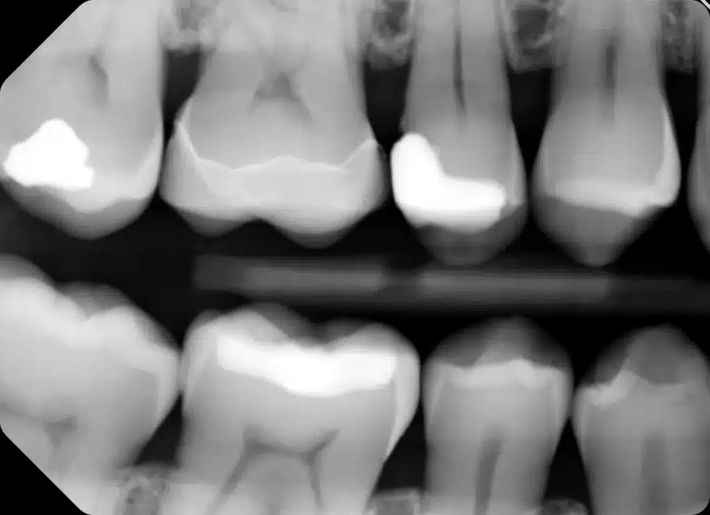 Home. Dentist in Garland, TX. Dr. Sarah Chan, DDS. Treat Dental