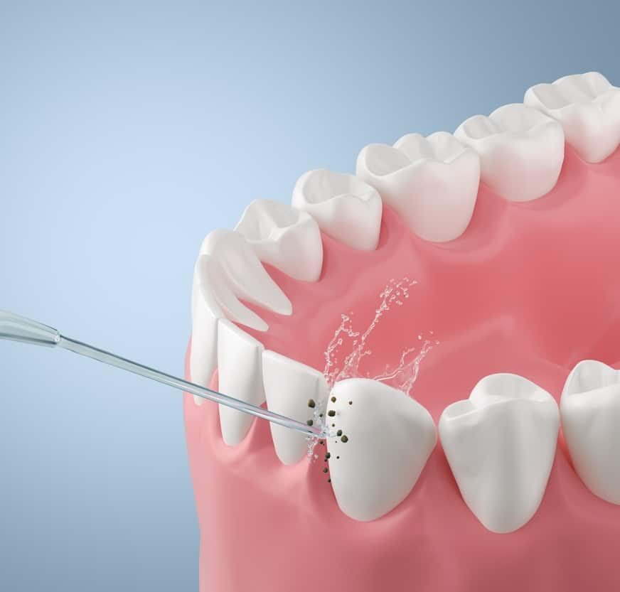 Dental Services. Dentist in Garland, TX. Dr. Sarah Chan, DDS. Treat Dental